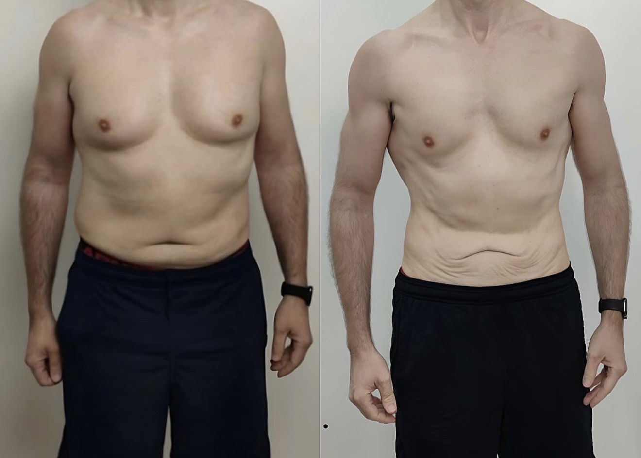 Client transformation